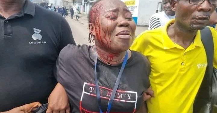 RDC : La marche de l&rsquo;opposition étouffée par la Police