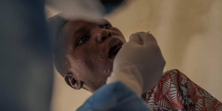 Mpox : « il n&rsquo;y a pas de raison d&rsquo;envisager le report de la rentrée scolaire » ( Roger Kamba )