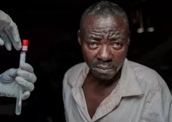 RDC : 200 000 doses de vaccin contre la variole du singe reçues