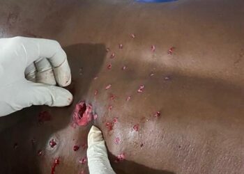 Mont-Ngafula : nuit de terreur à Matadi-Mayo, un père de famille grièvement blessé par balle