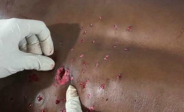 Mont-Ngafula : nuit de terreur à Matadi-Mayo, un père de famille grièvement blessé par balle