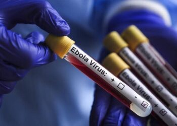 Ebola : un premier cas confirmé à Oïcha, les autorités sanitaires en alerte