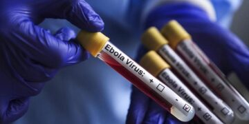 Ebola : un premier cas confirmé à Oïcha, les autorités sanitaires en alerte