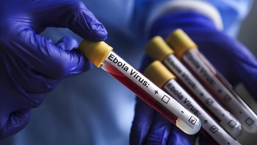 Ebola : un premier cas confirmé à Oïcha, les autorités sanitaires en alerte