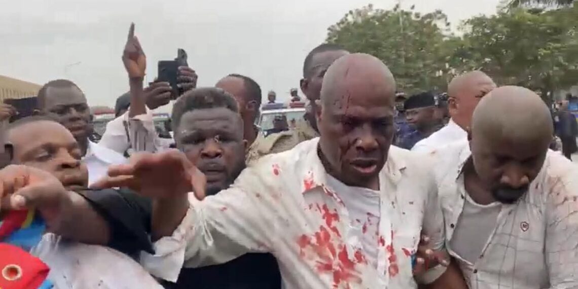 Palais du Peuple : au cœur des tensions, Martin Fayulu évacué dans la confusion
