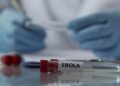 Ebola : un médecin ayant travaillé en Ituri diagnostiqué en France, Kinshasa et Paris activent l&rsquo;alerte sanitaire