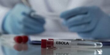Ebola : un médecin ayant travaillé en Ituri diagnostiqué en France, Kinshasa et Paris activent l&rsquo;alerte sanitaire